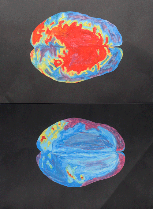 Brain scans, by Lydia Hartshorn: entry for Imagining The Brain 2010