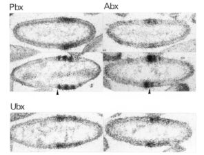 PBX and ABX are parasegment-specific remote enhancers of Ultrabithorax PBX and ABX are parasegment-specific remote enhancers of Ultrabithorax
