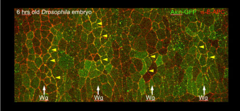 E-APC is recruited into membrane-associated Axin-GFP degradasomes E-APC is recruited into membrane-associated Axin-GFP degradasomes