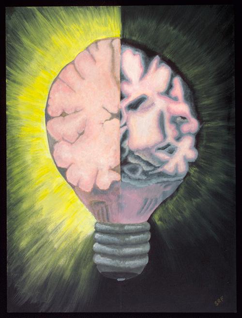 Artwork depicting; Neurodegeneration, Alzheimer's