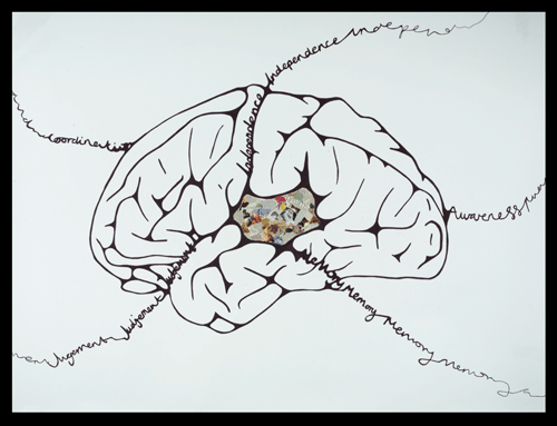 Artwork depicting; Neurodegeneration, Alzheimer's, Parkinson's