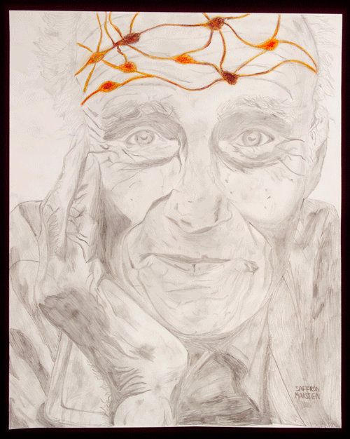 Artwork depicting; Neurodegeneration, Alzheimer's, Parkinson's