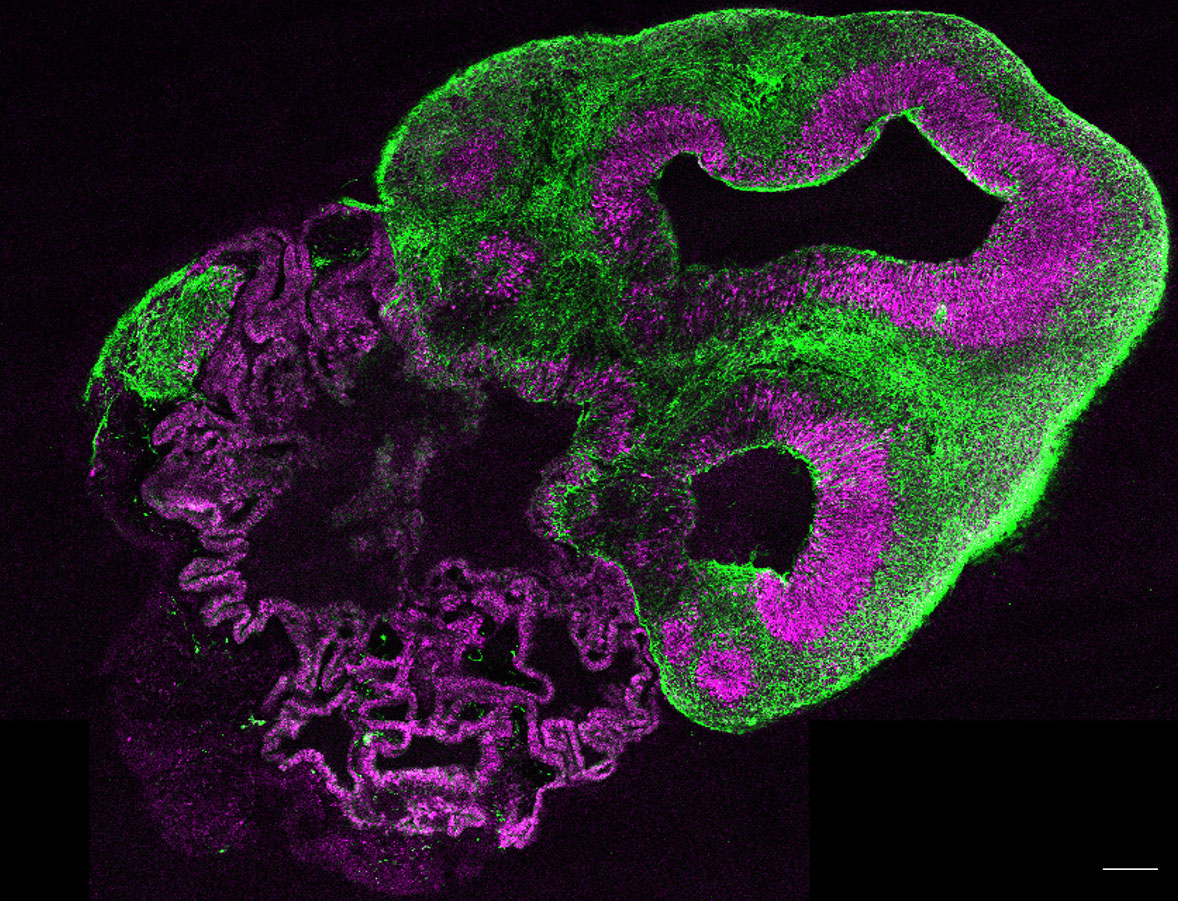 A section through a whole organoid stained for neurons in green and neural stem cells in magenta.