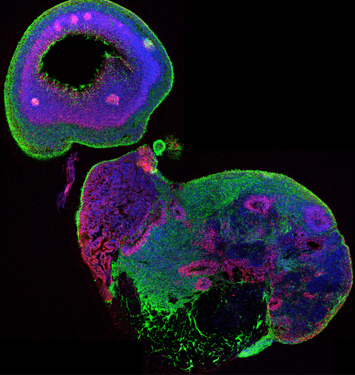 A section through a whole organoid stained for neurons in green and neural stem cells in red. All cell nuclei are stained in blue.