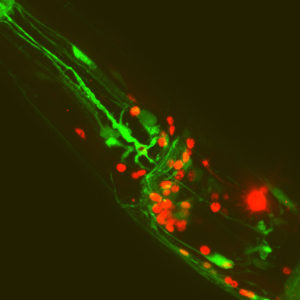 Green and red fluorescent proteins labelling different neuron types in the head of a worm