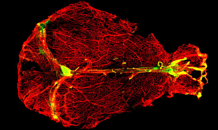 Antibody-producing plasma cells line the dural venous sinuses