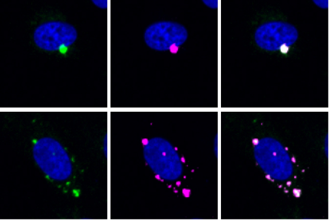 Example of output from the genome-wide screen. Cell in bottom row has dispersed peroxisomes (green and magenta) because a gene essential for dynein-based transport has been disrupted.