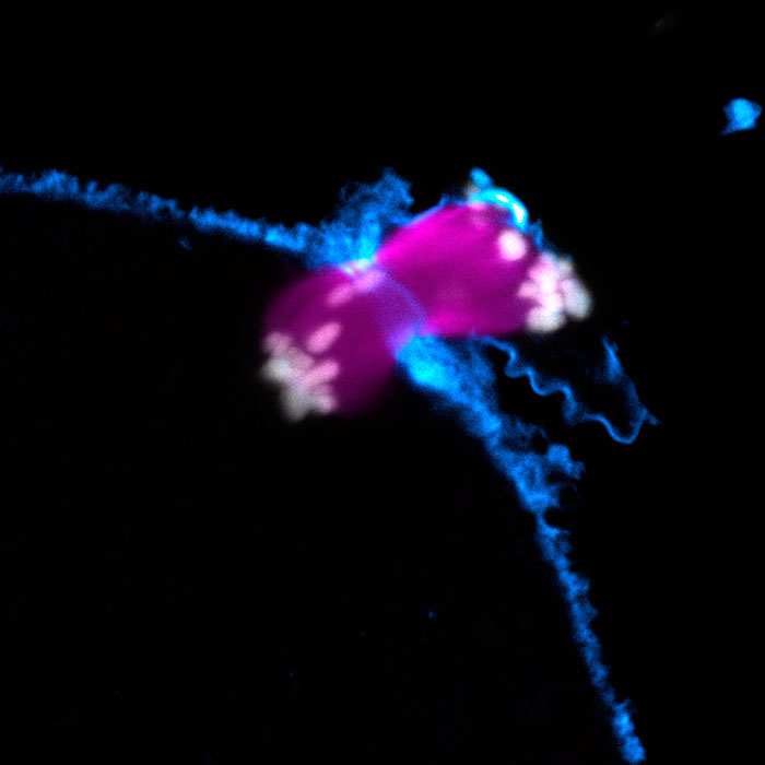 Human egg defects caused by error-prone spindle assembly - MRC ...