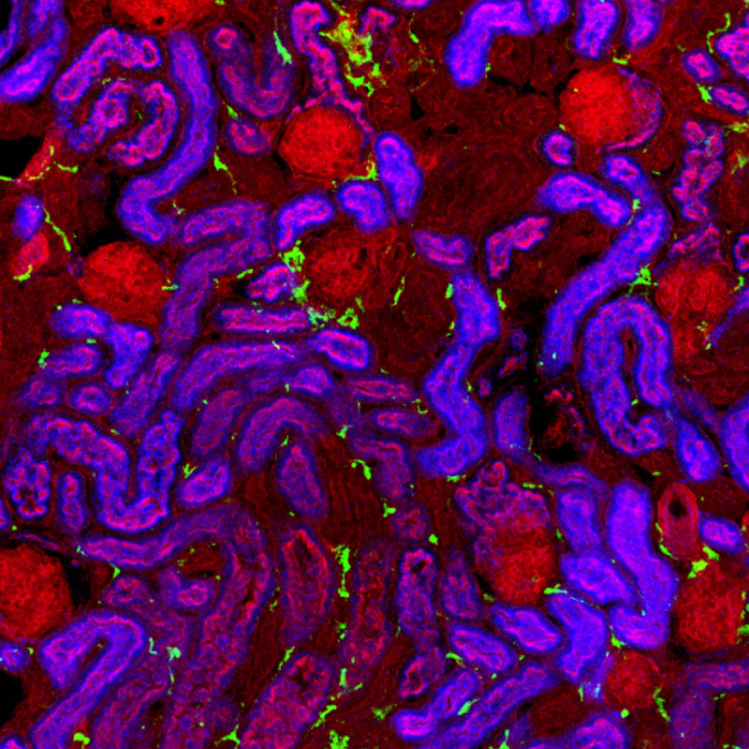 Mapping the human kidney - MRC Laboratory of Molecular Biology