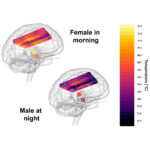 Temperature scale on the left hand side, using a colour scale that is mirrored in the brain on the right hand side which illustrates the varying temperatures across brain regions