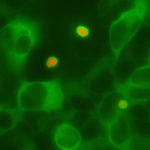 Ubiquilins (green) and Huntington’s disease aggregates (red) in a cell