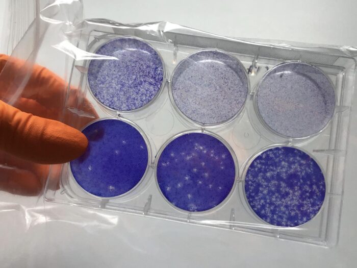 A plate in which a plaque assay has been performed to measure virus quantity in a sample. Cells are stained blue so that holes represent areas where viral infection has occurred