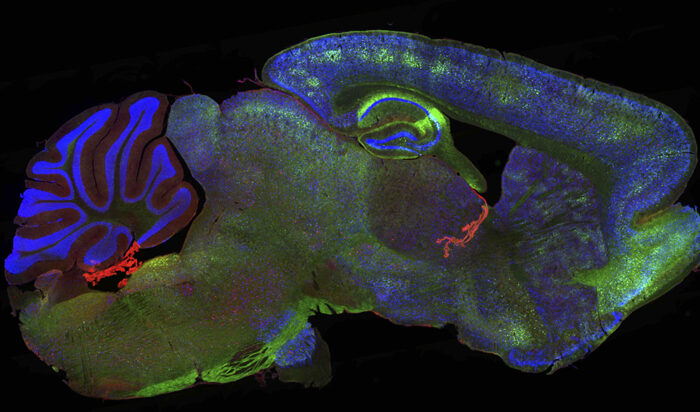 RING-Bait (green) and tau (red) in a mouse brain