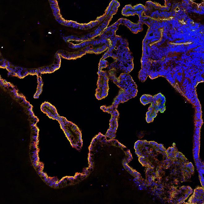 Microscopy image of the highly convoluted choroid plexus epithelium in organoids expressing tight junction markers and membrane transporters that regulate entry of molecules into the brain