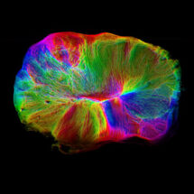 An improved brain organoid cultured at the air-liquid interface showing aligned nerve bundles, colour-coded by their orientation.