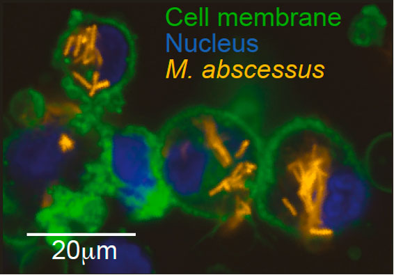 M. abscessus infection of human macrophage cell line (THP1) imaged through high content microscopy