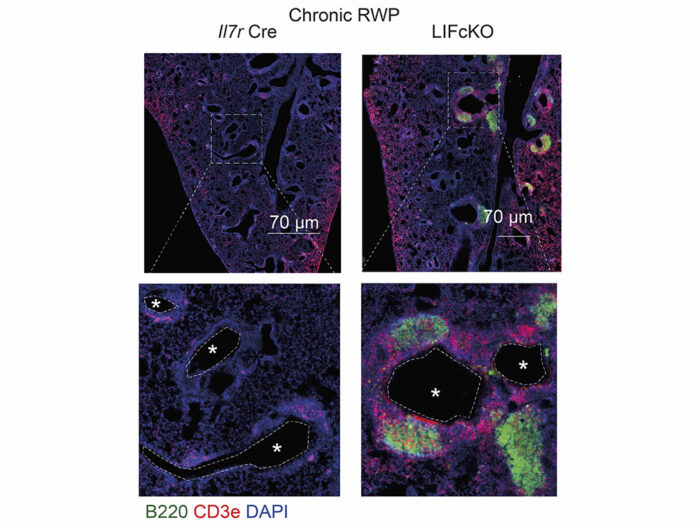 Immunofluorescence microscopy image of lung showing tertiary lymphoid tissue formation in LIF knock-out mice, but not control mice, following chronic allergen challenge. Tertiary lymphoid tissue is identified in LIF knock-out mice by presence of B cells, stained with B220 antibody (green), and T cells, stained with CD3e antibody (red).