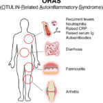 Graphical depiction of symptoms of ORAS (OTULIN-related Autoinflammatory Syndrome)