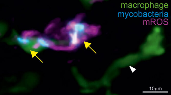 TNF induces mROS specifically in macrophages infected with TB mycobacteria (yellow arrows) but not in uninfected macrophages (white arrowhead) from the same zebrafish larva.