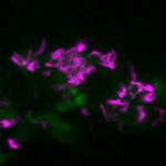 Ruptured infected macrophages (in green) and mycobacteria (in magenta) growing extracellularly