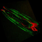Expression of mechanotransduction ion channels in the touch neurons (red) and muscle cells (green) of a worm