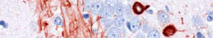Microscopy image