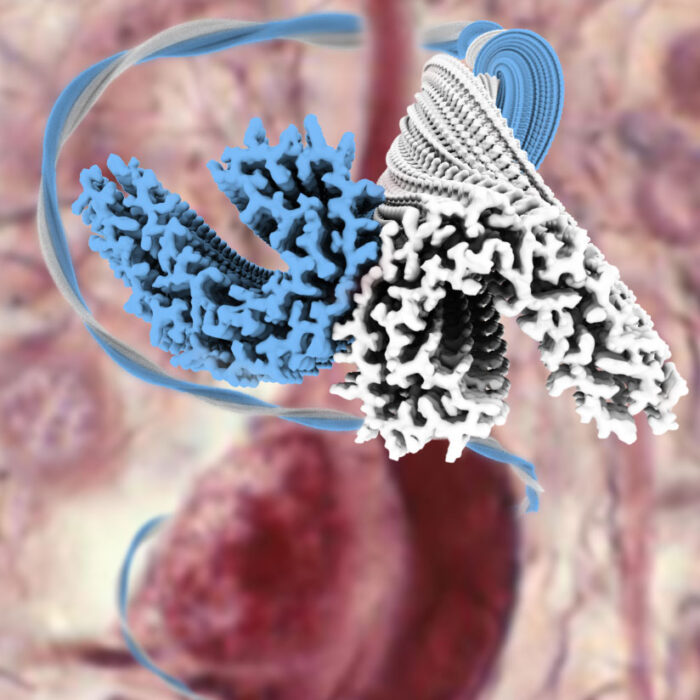 Amyloid filaments made of the protein Tau from Alzheimer's disease